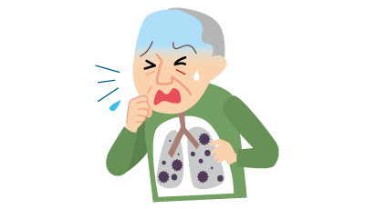 高齢者の肺炎球菌感染症